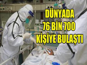 Dünya Genelinde 76 Bini Aştı