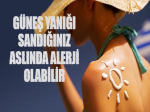 Güneş Yanığı Sandığınız Alerji Olabilir